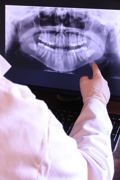 Best Emergency Denture Repair in North Sarasota, FL
